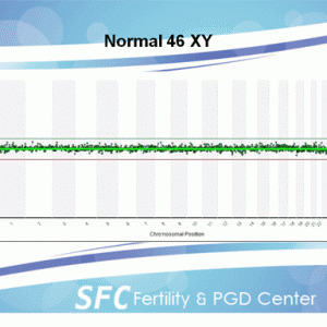 PGD-aCGH