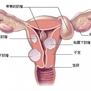 ӹ̩ԹӤӰ죿